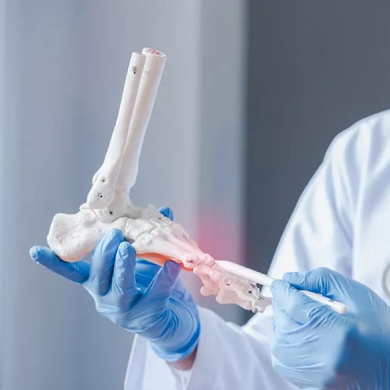 Chirurgie Orthopédique